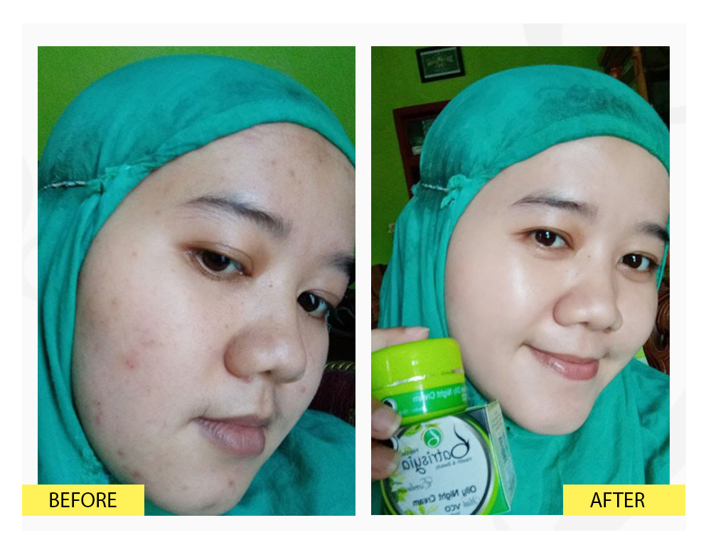 EXCLUSIVE OILY NIGHT CREAM