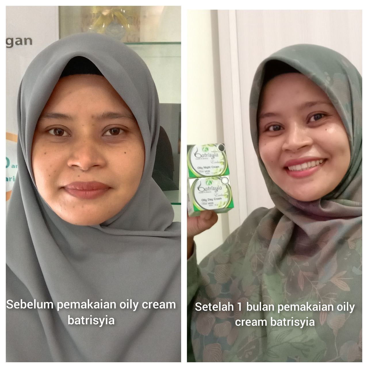 Manfaat Oily Cream Day & Night